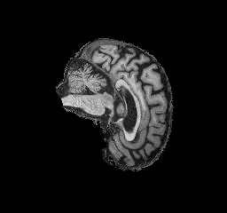 Alzheimer's Classification screenshot